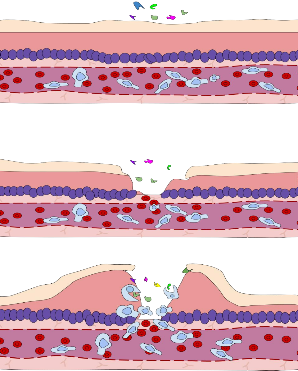 Immune response